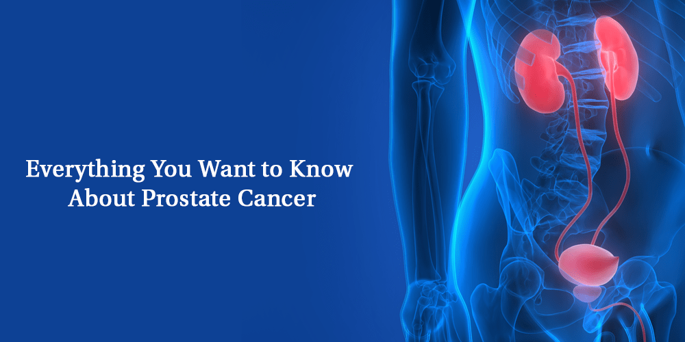 Everything You Want to Know About Prostate Cancer